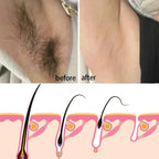60g Fast Hair Removal Cream Painless Hairs Growth - Kart It Up   - 60g Fast Hair Removal Cream Painless Hairs Growth - Kart It Up   - 60g Fast Hair Removal Cream Painless Hairs Growth - Kart It Up   - 60g Fast Hair Removal Cream Painless Hairs Growth - Kart It Up  - 60g Fast Hair Removal Cream Painless Hairs Growth - Kart It Up  -  -  