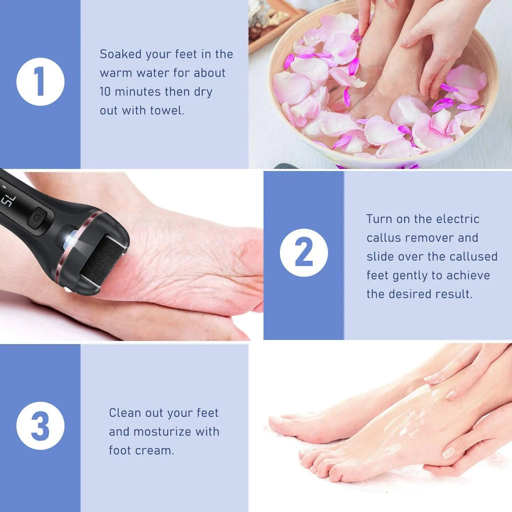 Electric Grinding Pedicure Tool Set - Kart It Up   - Electric Grinding Pedicure Tool Set - Kart It Up   - Electric Grinding Pedicure Tool Set - Kart It Up   - Electric Grinding Pedicure Tool Set - Kart It Up   - Electric Grinding Pedicure Tool Set - Kart It Up  - Electric Grinding Pedicure Tool Set - Kart It Up  -  -  