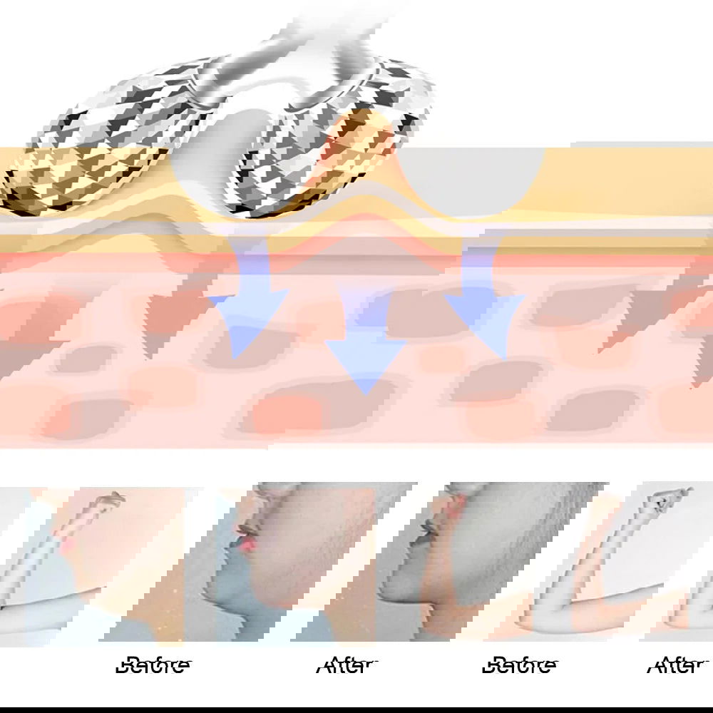 Facial 3D roller massager Face Lift Hands Full Body Skin Relaxation - Kart It Up   - Facial 3D roller massager Face Lift Hands Full Body Skin Relaxation - Kart It Up   - Facial 3D roller massager Face Lift Hands Full Body Skin Relaxation - Kart It Up   - Facial 3D roller massager Face Lift Hands Full Body Skin Relaxation - Kart It Up  - Facial 3D roller massager Face Lift Hands Full Body Skin Relaxation - Kart It Up  -  