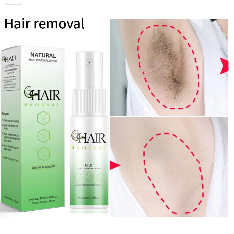 Fast Hair Removal Spray Set Painless Hair Growth Inhibitor - Kart It Up   - Fast Hair Removal Spray Set Painless Hair Growth Inhibitor - Kart It Up   - Fast Hair Removal Spray Set Painless Hair Growth Inhibitor - Kart It Up   - Fast Hair Removal Spray Set Painless Hair Growth Inhibitor - Kart It Up   - Fast Hair Removal Spray Set Painless Hair Growth Inhibitor - Kart It Up  - Fast Hair Removal Spray Set Painless Hair Growth Inhibitor - Kart It Up  -  -  