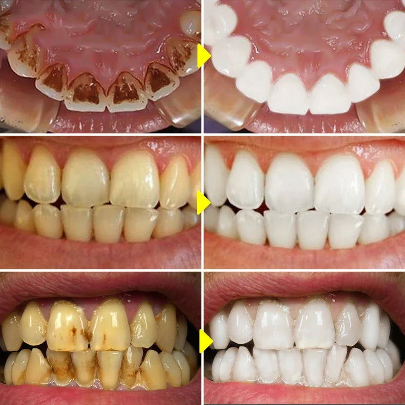 Purple Toothpaste Teet - Kart It Up   - Purple Toothpaste Teet - Kart It Up   - Purple Toothpaste Teet - Kart It Up   - Purple Toothpaste Teet - Kart It Up   - Purple Toothpaste Teet - Kart It Up   - Purple Toothpaste Teet - Kart It Up  - Purple Toothpaste Teet - Kart It Up  -   - 