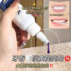 Purple Toothpaste Teet - Kart It Up   - Purple Toothpaste Teet - Kart It Up   - Purple Toothpaste Teet - Kart It Up   - Purple Toothpaste Teet - Kart It Up  - Purple Toothpaste Teet - Kart It Up  -  - 