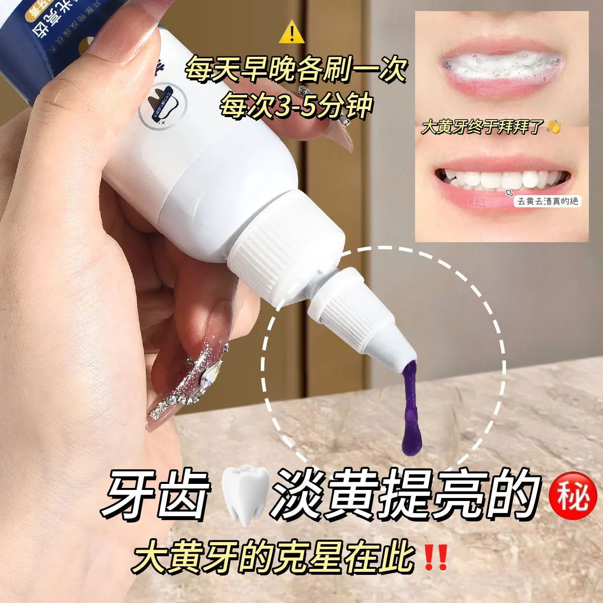 Purple Toothpaste Teet - Kart It Up   - Purple Toothpaste Teet - Kart It Up   - Purple Toothpaste Teet - Kart It Up   - Purple Toothpaste Teet - Kart It Up  - Purple Toothpaste Teet - Kart It Up  -  - 