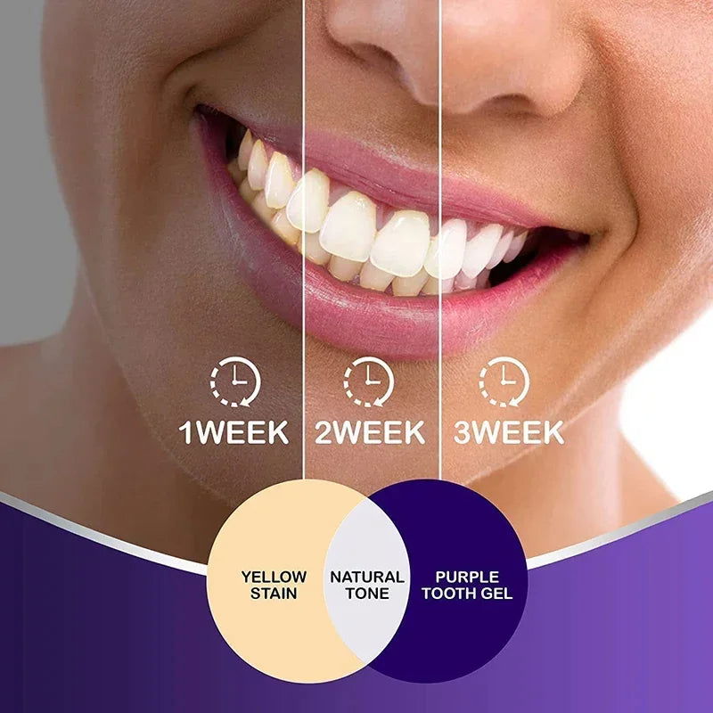 Purple Toothpaste Teet - Kart It Up   - Purple Toothpaste Teet - Kart It Up   - Purple Toothpaste Teet - Kart It Up   - Purple Toothpaste Teet - Kart It Up  - Purple Toothpaste Teet - Kart It Up  -  - 