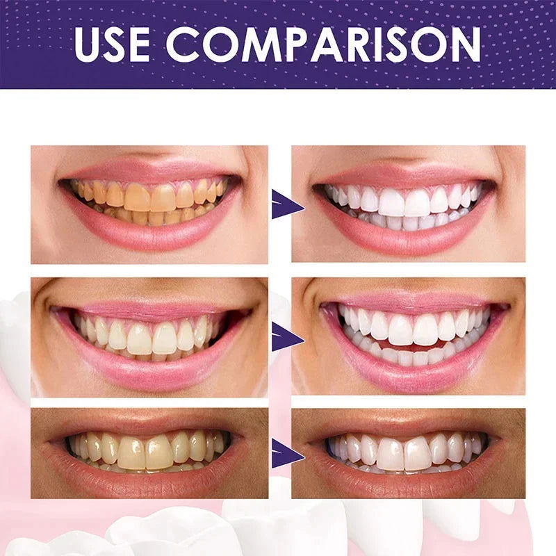 Purple Toothpaste Teet - Kart It Up   - Purple Toothpaste Teet - Kart It Up   - Purple Toothpaste Teet - Kart It Up   - Purple Toothpaste Teet - Kart It Up  - Purple Toothpaste Teet - Kart It Up  -  - 