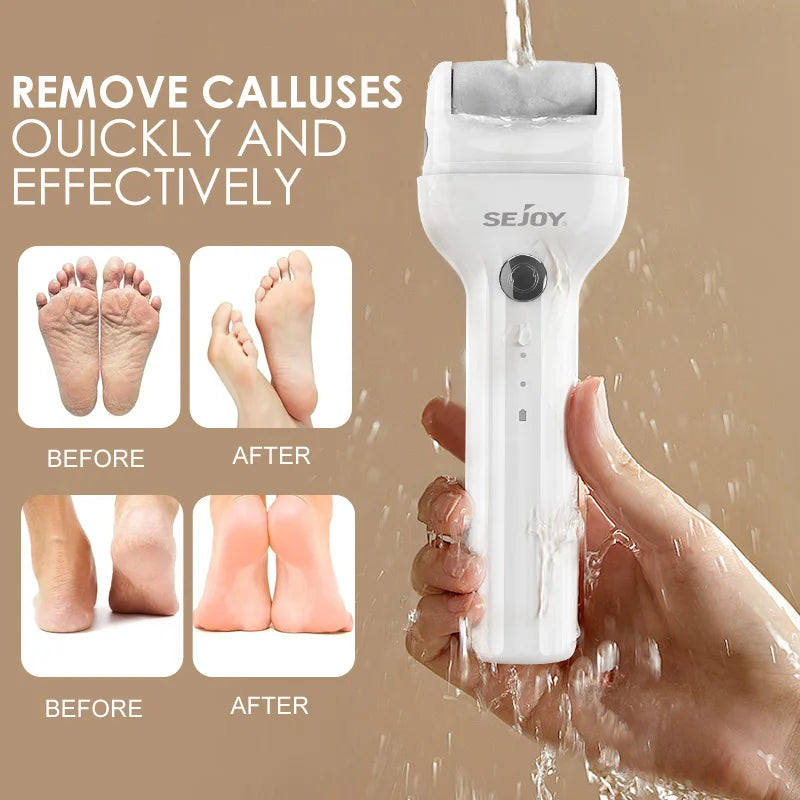 SEJOY Electric Foot Callus Remover Electric Pedicure Machine Adjustable Speed with 2 Replacement Sandpaper Foot Pedicure
