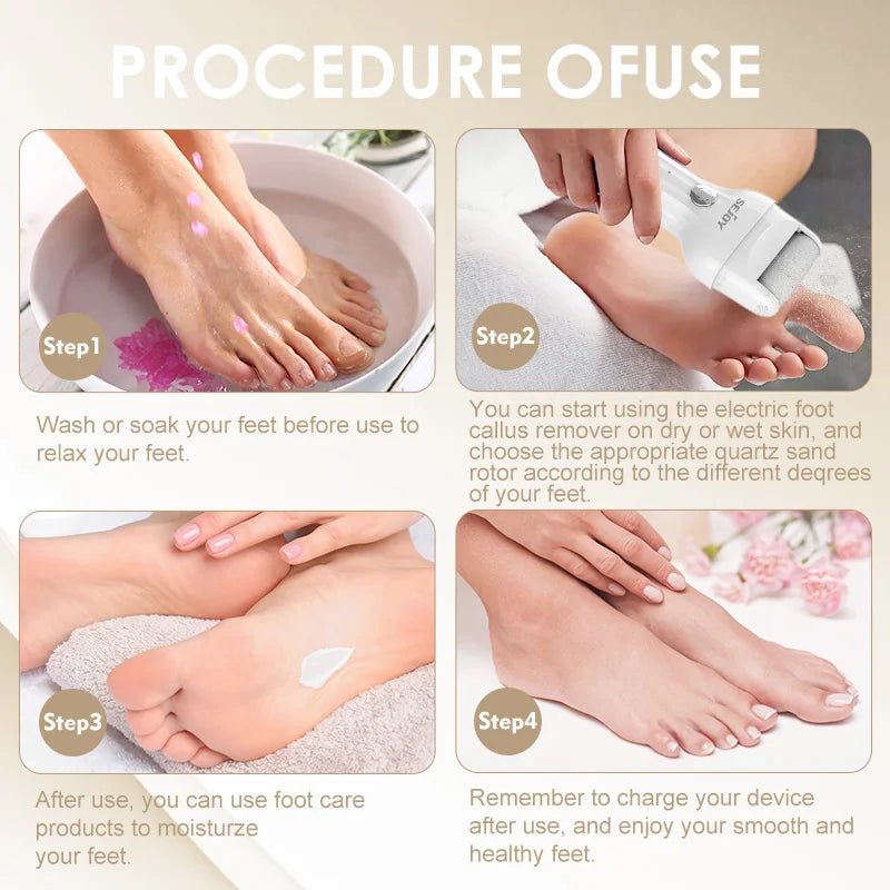 SEJOY Electric Foot Callus Remover Electric Pedicure Machine Adjustable Speed with 2 Replacement Sandpaper Foot Pedicure