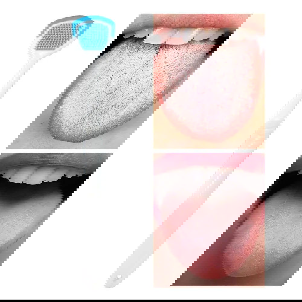 Tongue Scraper Beauty Health - Kart It Up   - Tongue Scraper Beauty Health - Kart It Up   - Tongue Scraper Beauty Health - Kart It Up   - Tongue Scraper Beauty Health - Kart It Up   - Tongue Scraper Beauty Health - Kart It Up  - Tongue Scraper Beauty Health - Kart It Up  -  - 