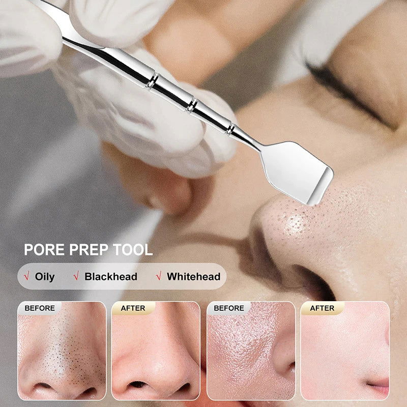 Two-sided Blackhead Remover Spatula - Kart It Up   - Two-sided Blackhead Remover Spatula - Kart It Up   - Two-sided Blackhead Remover Spatula - Kart It Up   - Two-sided Blackhead Remover Spatula - Kart It Up   - Two-sided Blackhead Remover Spatula - Kart It Up   - Two-sided Blackhead Remover Spatula - Kart It Up  - Two-sided Blackhead Remover Spatula - Kart It Up  -   - 